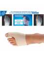orthese-nuit-thermoformable-hallux-valgus.jpg